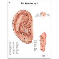Acupunctura urechei