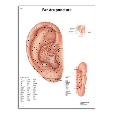 Acupunctura urechei