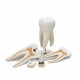 Model Molar gigant cu prezentarea cavitatilor dentare