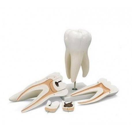Model Molar gigant cu prezentarea cavitatilor dentare